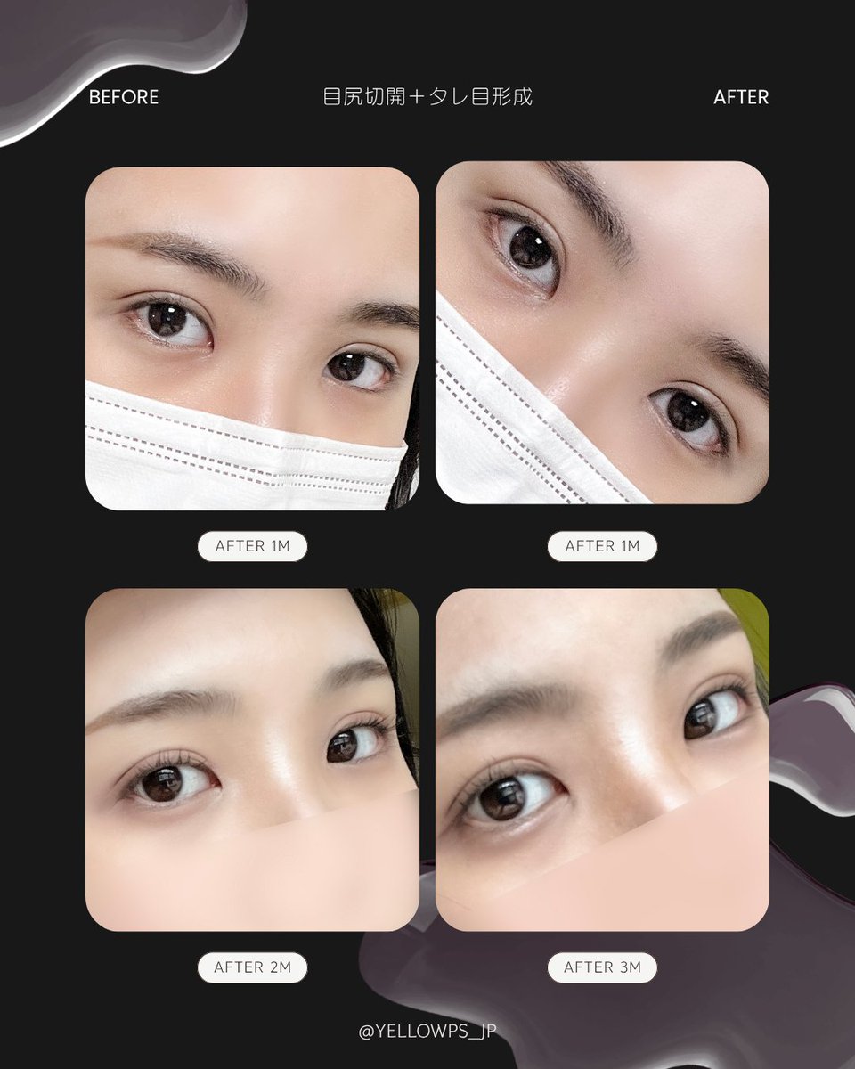 💛イエロー美容整形外科(公式)💛 tweet media