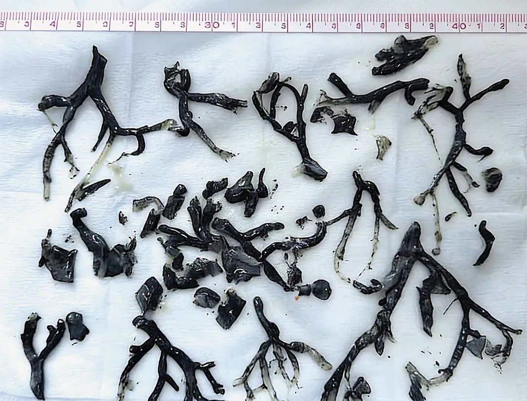 เฉียนเฉี่ยน tweet media