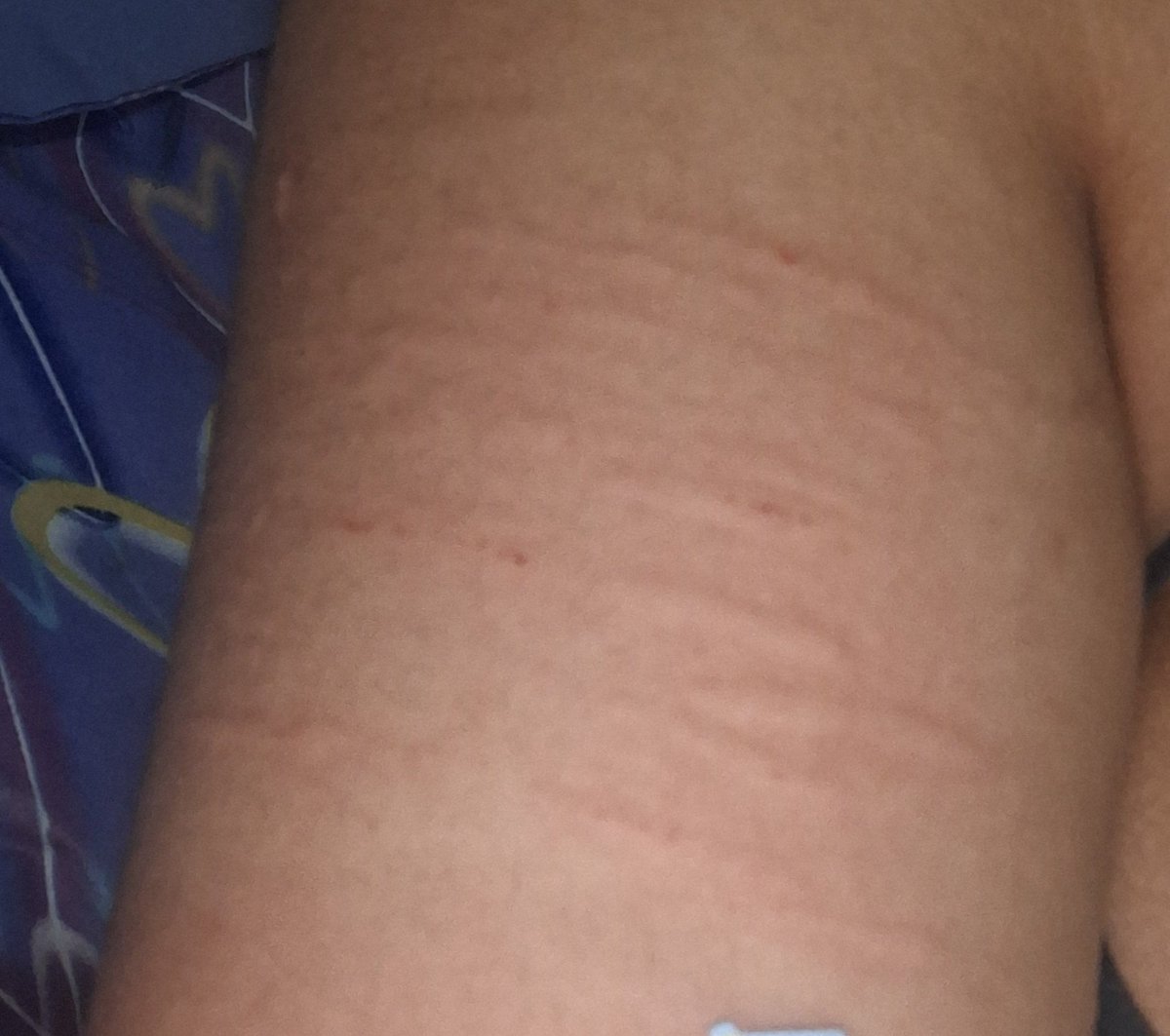 — 𝘞𝘪𝘨𝘪 tweet media