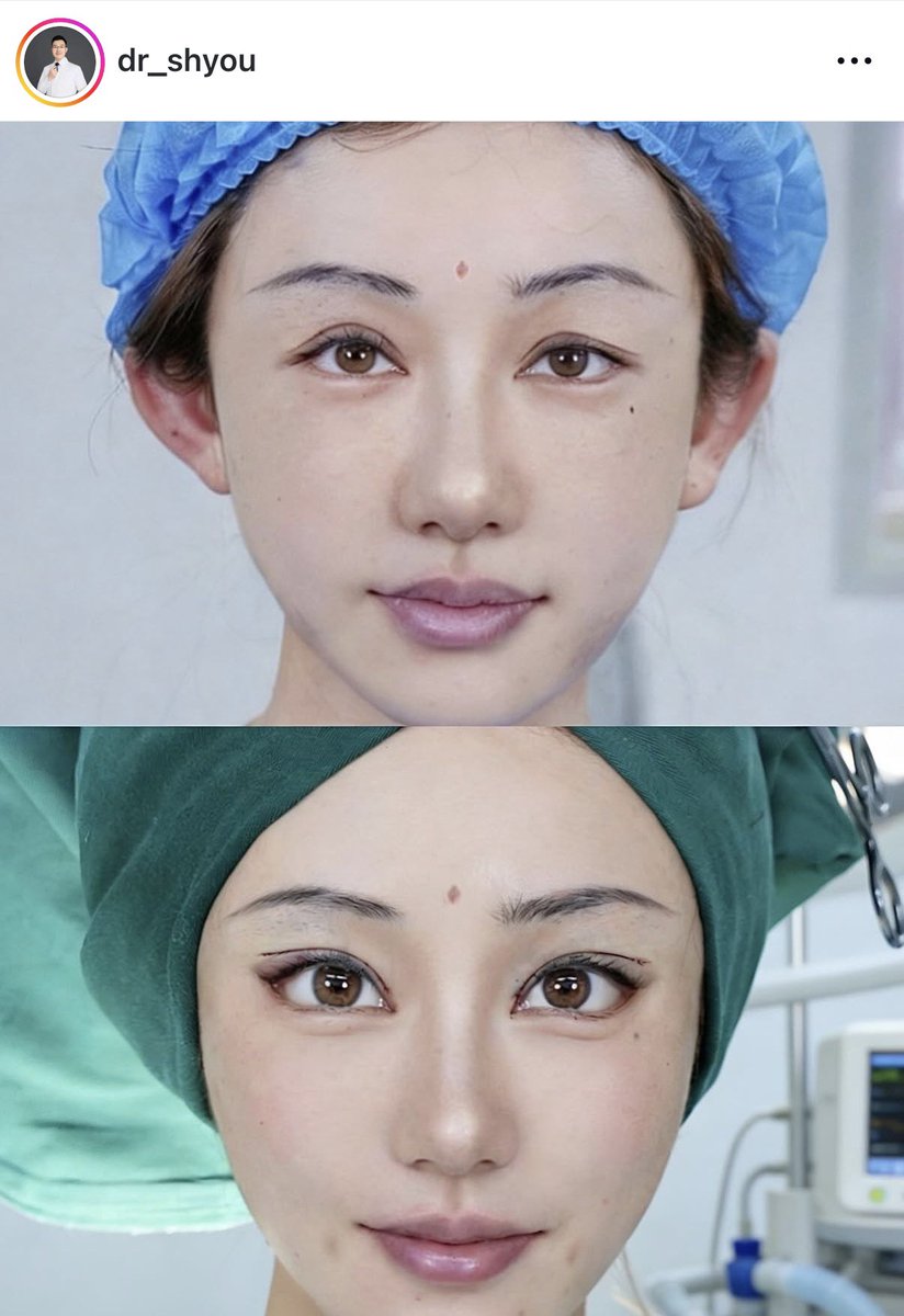 Rabichan🐰🩷整形YouTube👀 tweet media