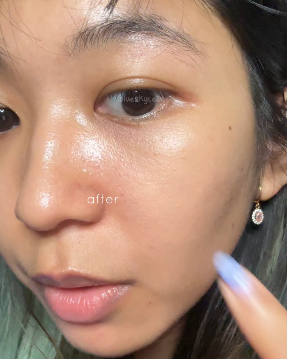 iren || normal to dry skin✨ tweet media