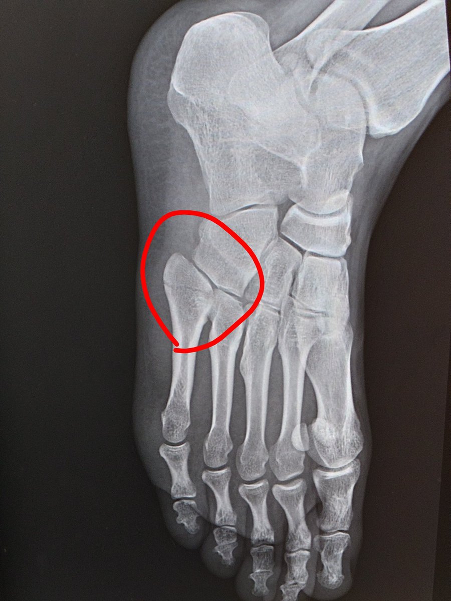 まちぁmagic tweet media