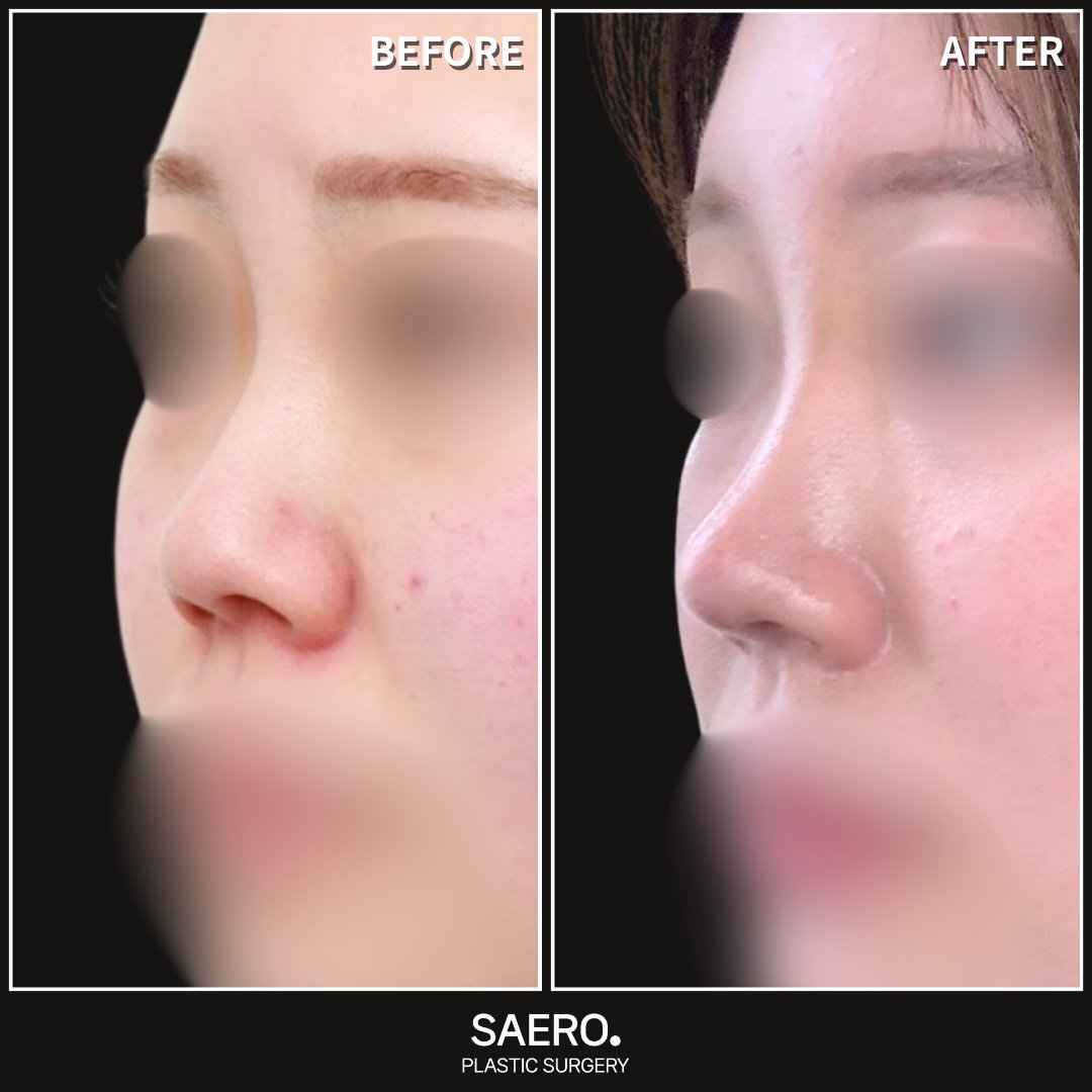 セロ美容外科 tweet media