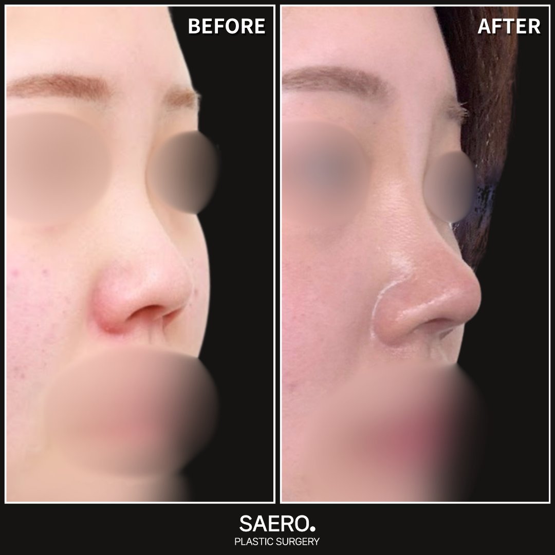 セロ美容外科 tweet media