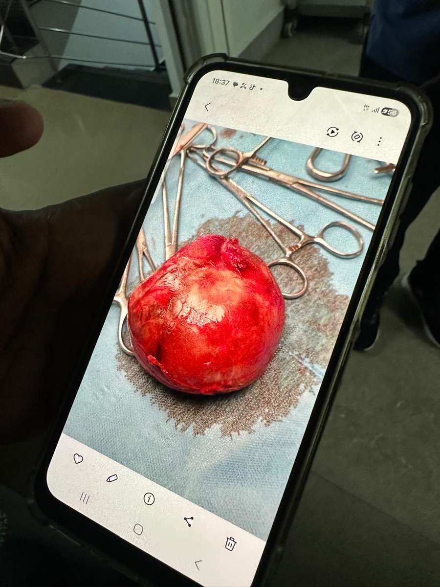 drawaale's tweet image. The Surgeon and the smartphone- Wanna see my Surgery pictures

#welcarespecialityhospital 
#patient