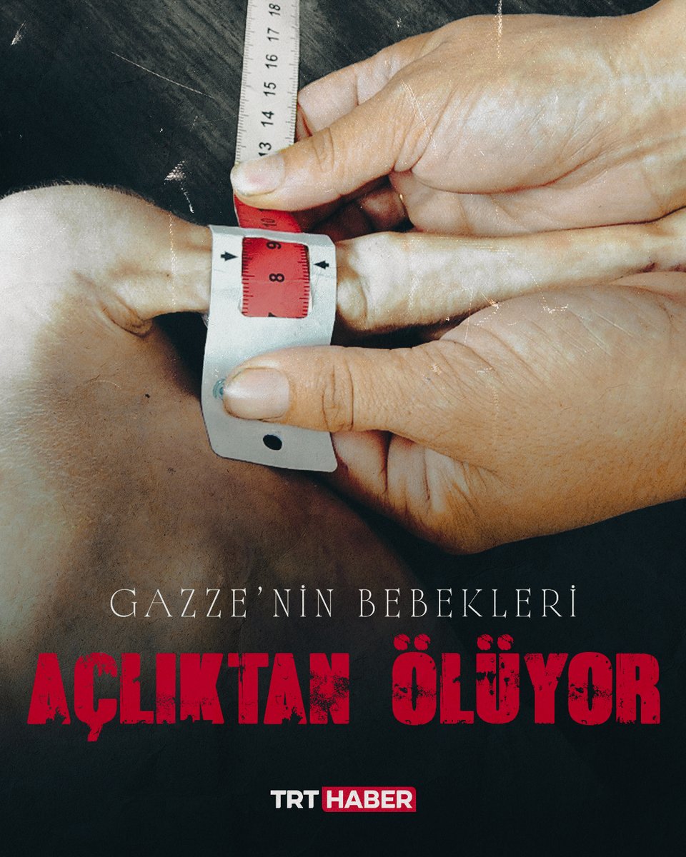 Katil İsrail'in insani yardım girişini engellediği Gazze'de bebekler açlıktan ölüyor...