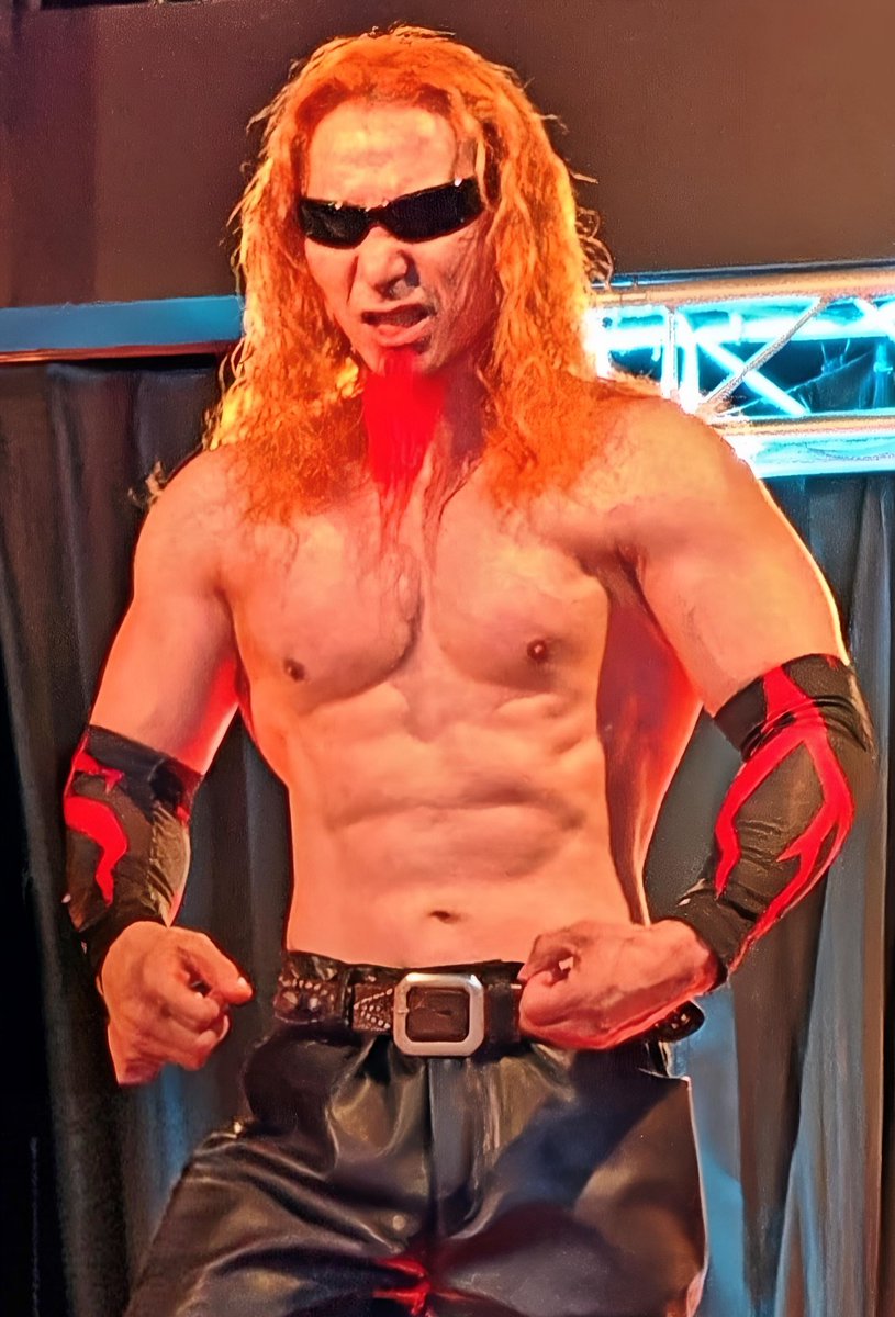 VALANKING027's tweet image. デビュー戦終了！メタルとプロレスの融合した魂で戦った激闘の証がこのアザ！Igniteファンの熱量と全選手の熱いプロレス魂が心に響いた！
これからも進化して行くぜ！
俺の生きざま目を離さず見ていてくれ！
#Ignite #ヴァランキング #メタル #metal