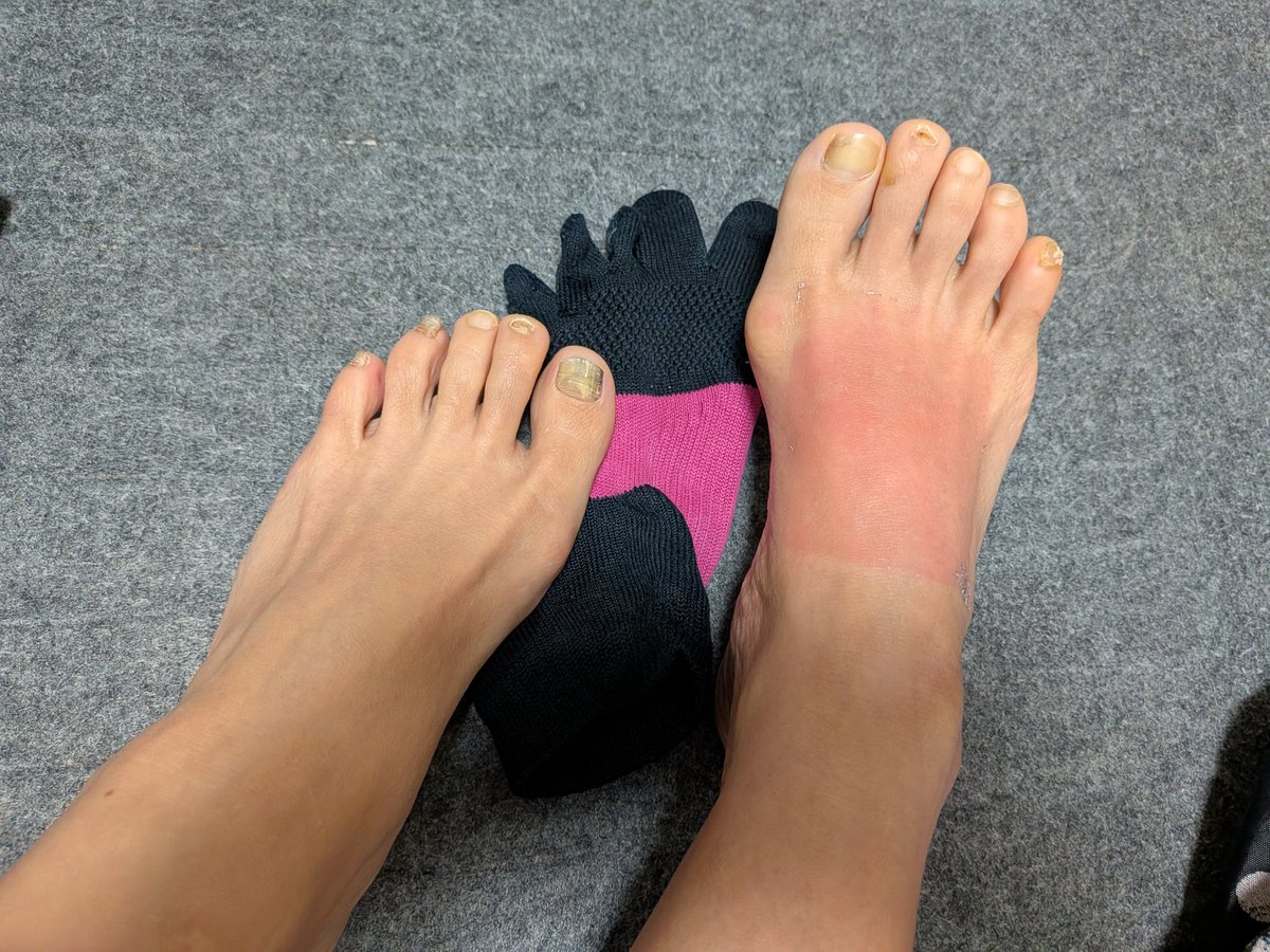 rei88fly tweet media