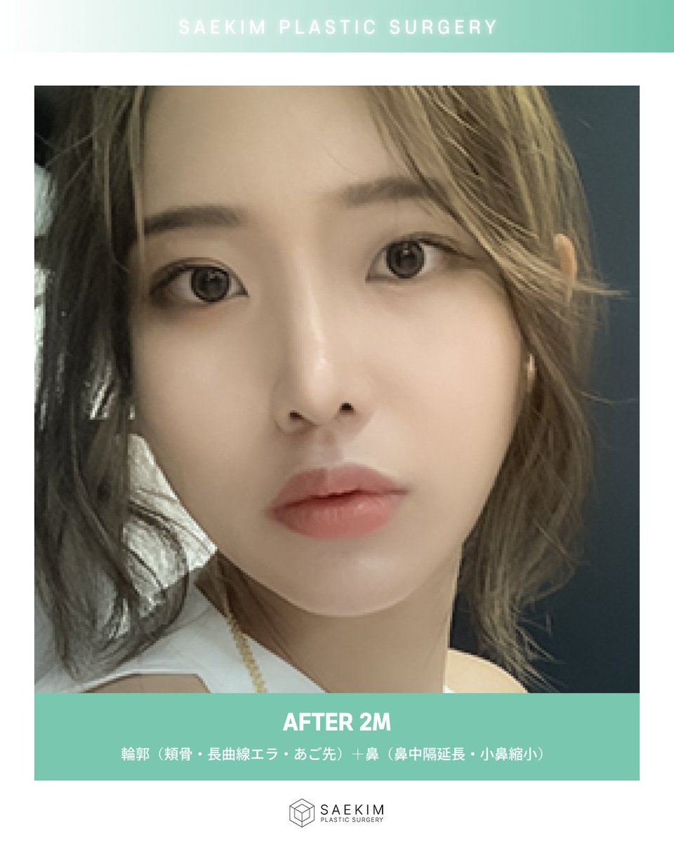 ❰公式❱💙セギム美容整形💙韓国 tweet media
