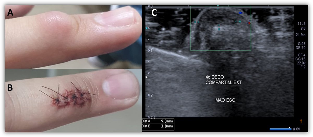Int Soc Dermpath tweet media
