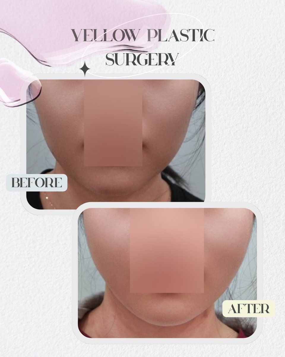 💛イエロー美容整形外科(公式)💛 tweet media
