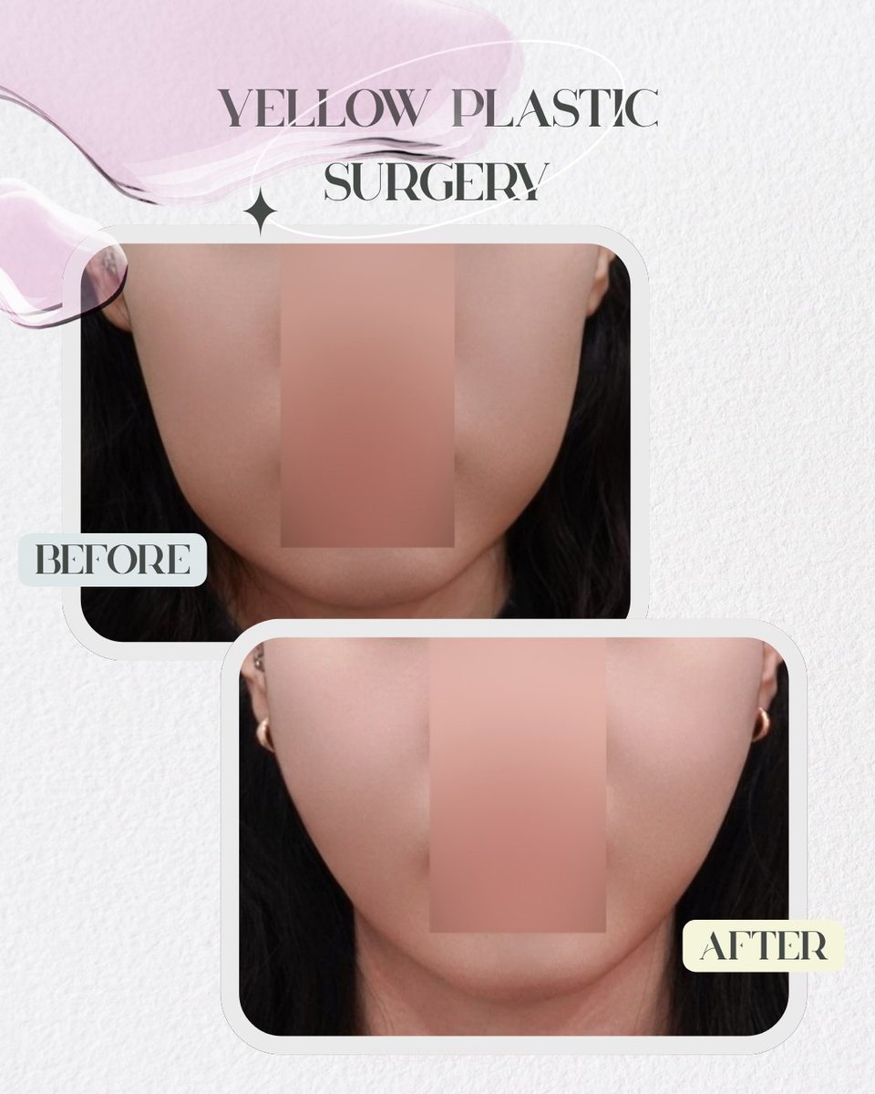 💛イエロー美容整形外科(公式)💛 tweet media
