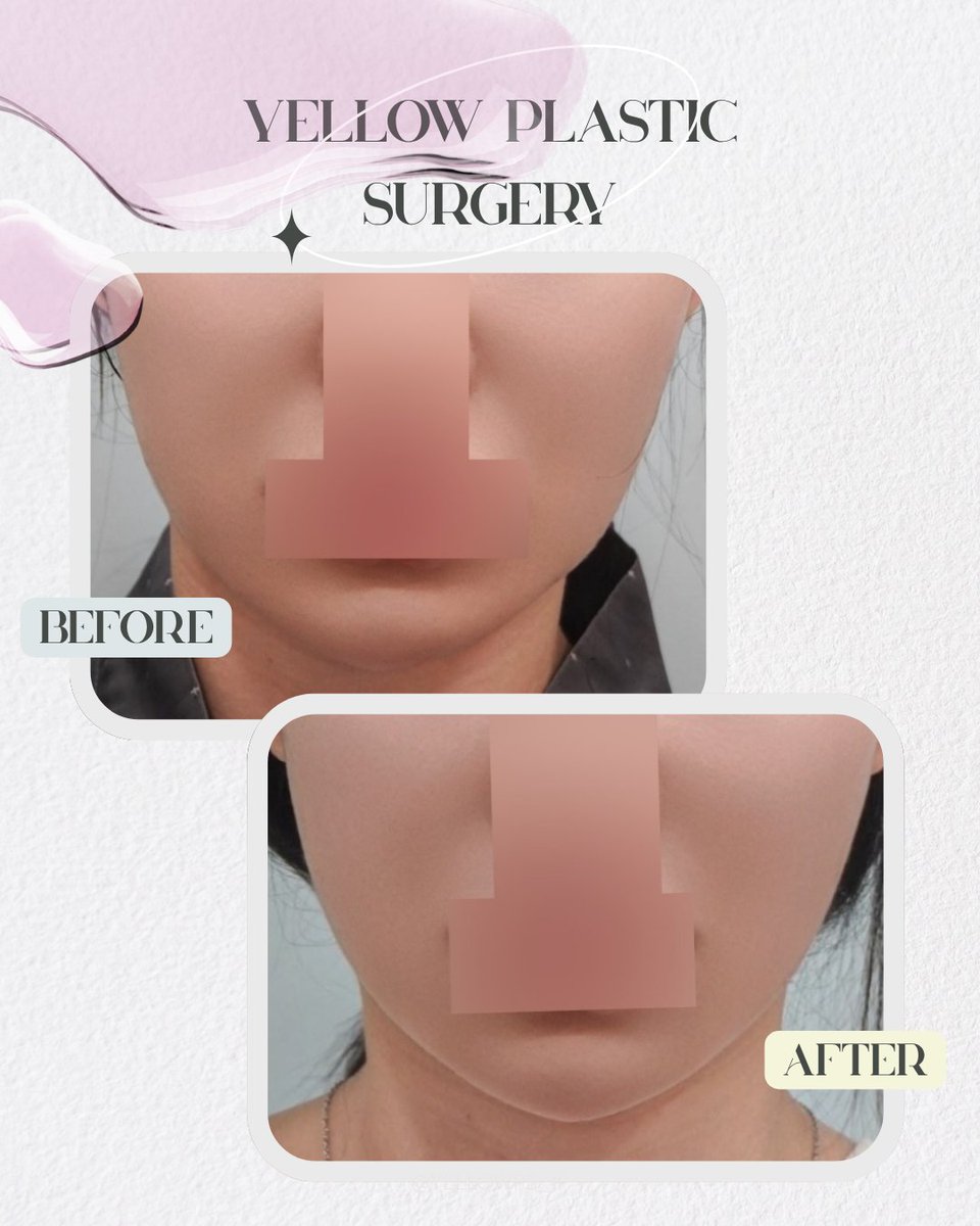 💛イエロー美容整形外科(公式)💛 tweet media