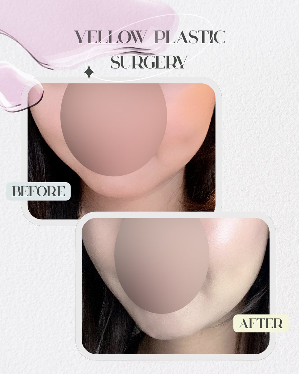 💛イエロー美容整形外科(公式)💛 tweet media