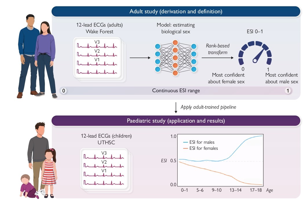 ESC_Journals's tweet image. ECG Sex Index in children and adolescents ow.ly/SKxU50YMoOL 

#EHJDigital #ArtificialIntelligence
@BruiningNico @rafavidalperez @fwasselbergs  @rbcasado @EHRAPresident