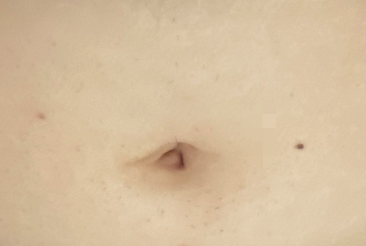 うさちゃん tweet media