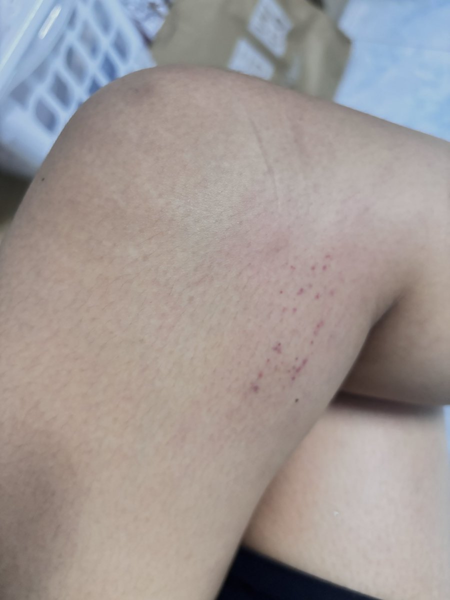 คู่หัดเล่น ระยอง tweet media