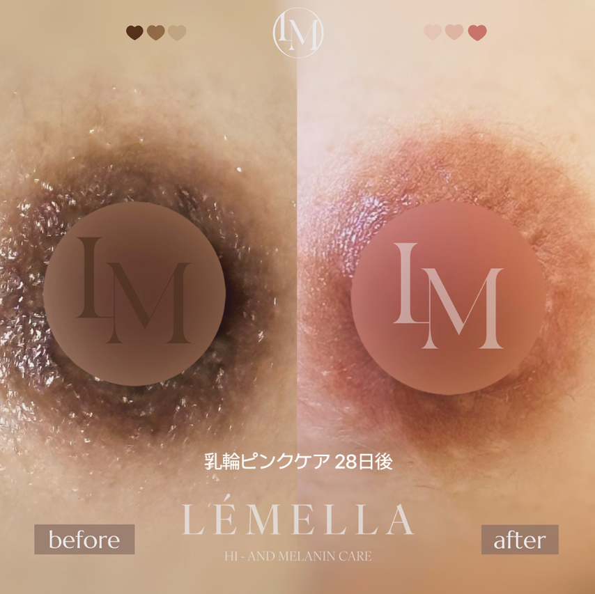 【韓国公式】ルメラ tweet media