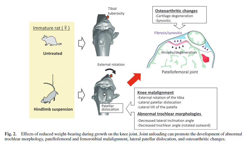 ptr_journal's tweet photo. Review Article
Anatomical Risk Factors for Lower Extremity Musculoskeletal Disorders and Proposed Prevention Strategies
https://t.co/0Bc1Iz033u
#BoneGeometry #Malalignment #MusculoskeletalDisorder #JointUnloading https://t.co/pZqXixzDKo