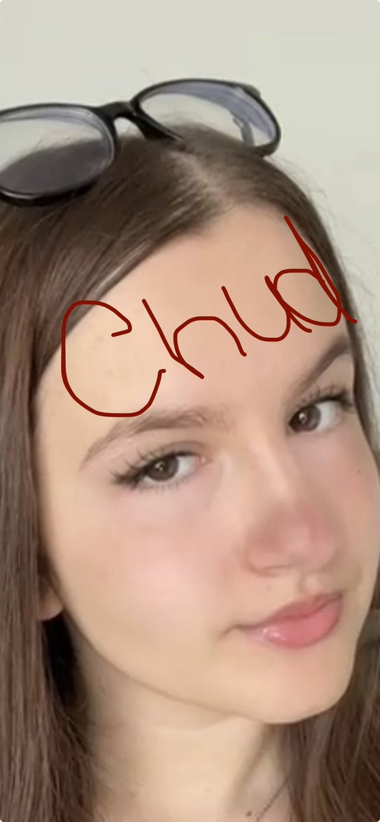 pinkfilesss's tweet image. “niggermind” but you look like this #ew #surgeryneed #fixthatnoseASAP #whyareyoubalding #whitepeoplegenes