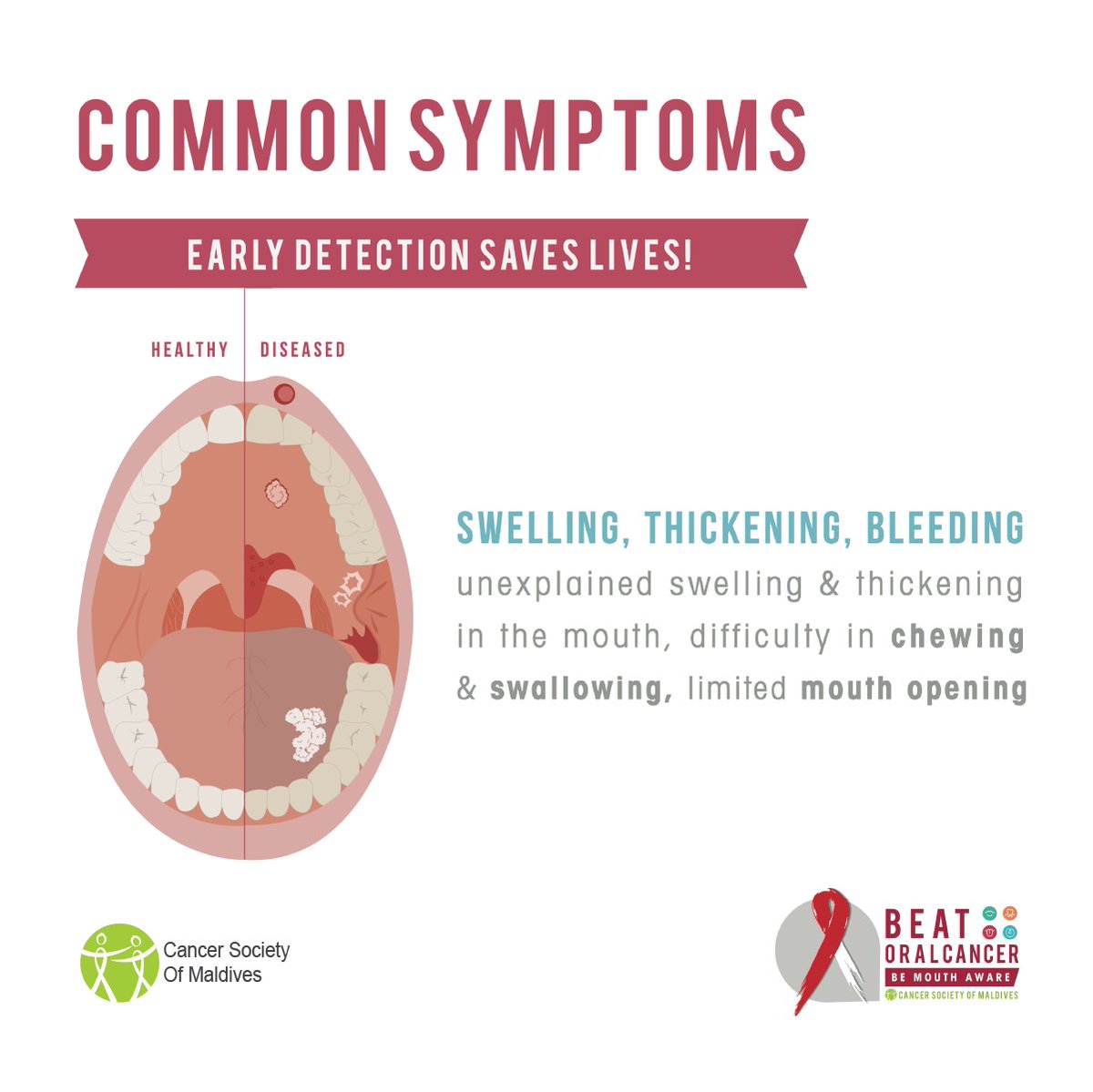 CancerSocietyMV's tweet photo. Early detection is our best defense against oral cancer, and being Mouth Aware can truly save lives. While symptoms can vary, it is vital to stay proactive and seek medical advice if you notice persistent changes.

#BeatOralCancer #BeMouthAware #CSM https://t.co/4XBulig9Eb