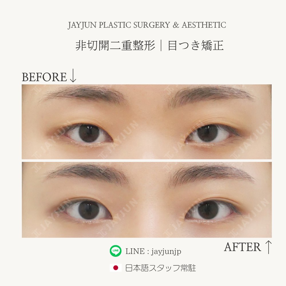 〚公式〛JAYJUN美容外科•皮膚科｜韓国美容 tweet media