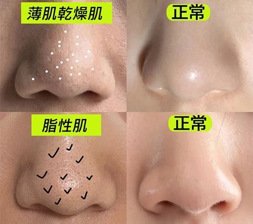 らん美容 tweet media