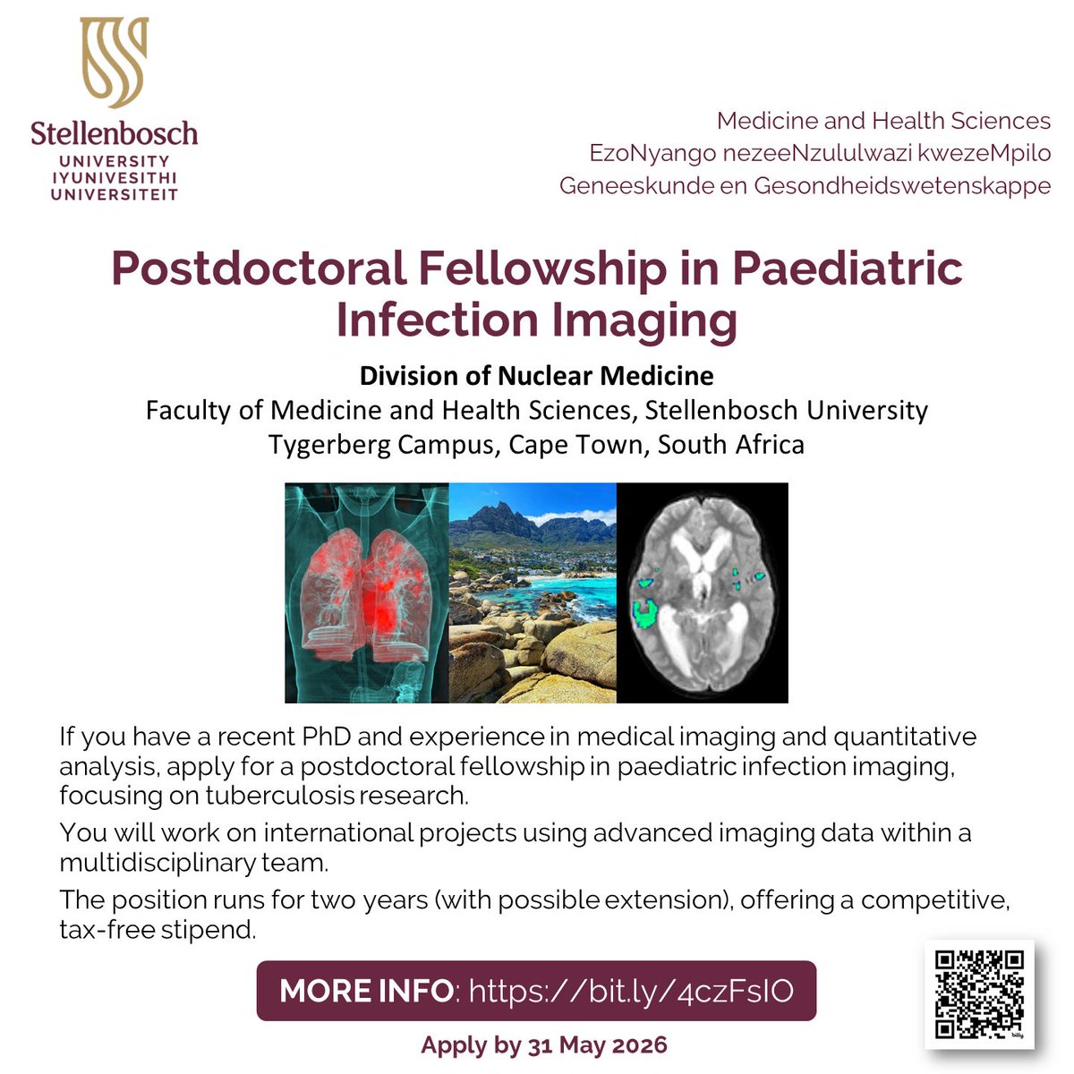 NITheCS's tweet image. Do you have a recent PhD and experience in medical imaging?
Apply for a Postdoctoral Fellowship in Paediatric Infection Imaging, focusing on tuberculosis research.
📍 Stellenbosch University Tygerberg Campus
bit.ly/4czFsIO 
#PostdocFellowship #MedicalImaging #TBResearch