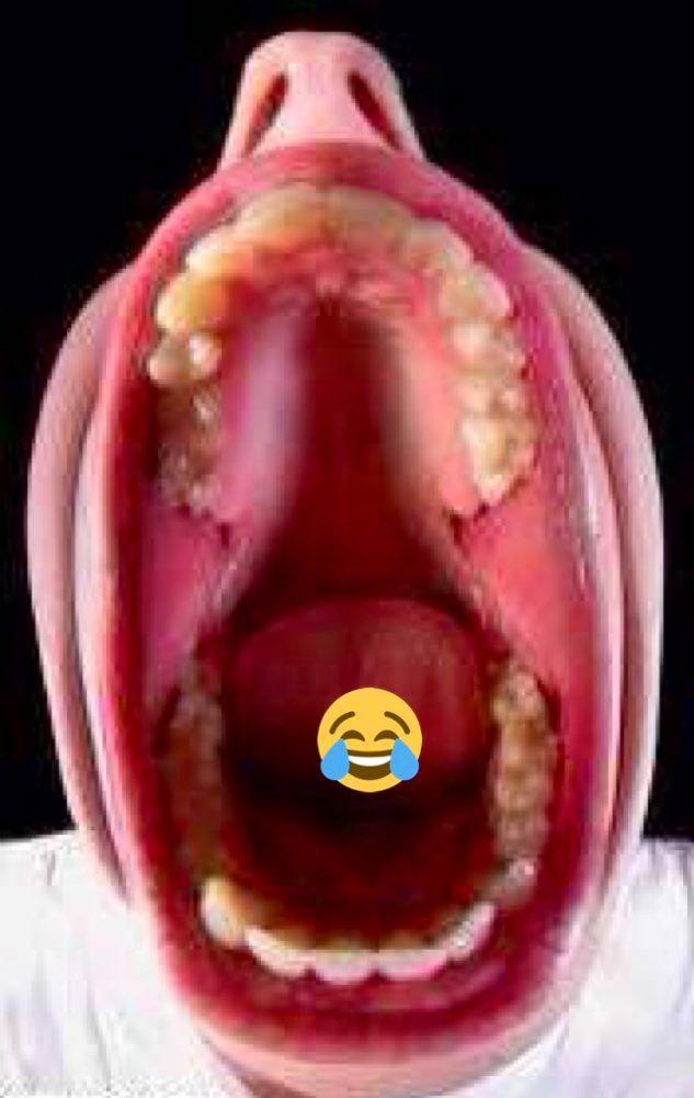 القرني tweet media