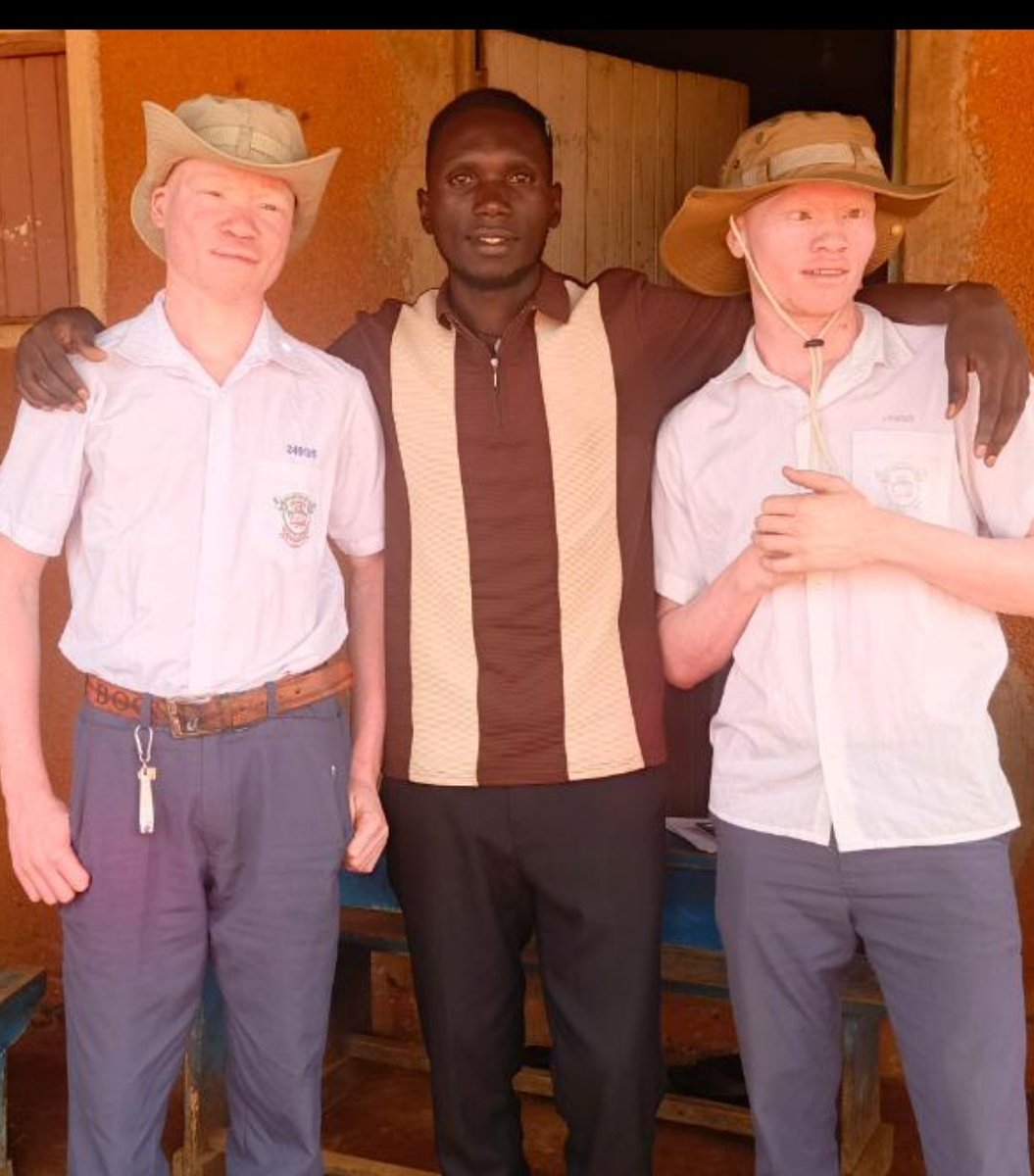 besigacaesar's tweet photo. "Our biggest problem is poverty, we are already worried of our employment after school because people don't want to give jobs to persons with albinism, it's painful" https://t.co/mGNzNL9GYx