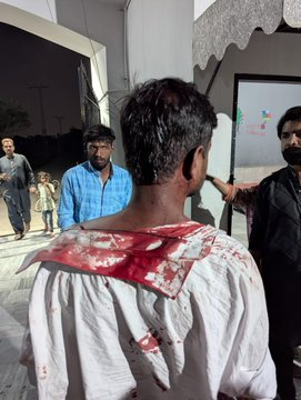 ayesha16g's tweet photo. Warning Graphic!
A #Christian family in #Lahore was reportedly attacked during a dispute over their ancestral graveyard, yet despite the severity of the incident, no arrests have been made so far.
#ChristiansUnderAttack https://t.co/WuemS9Hglg