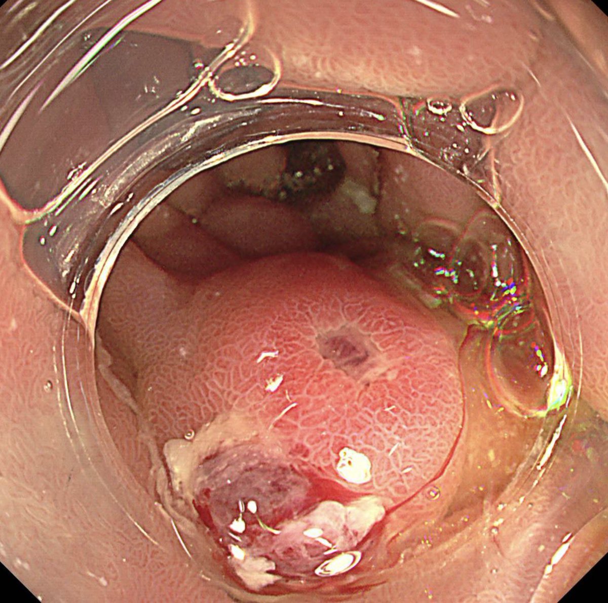 Keith Siau tweet media