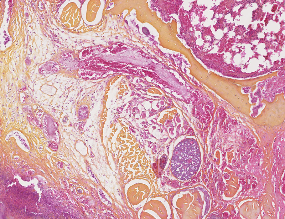 Science Translational Medicine tweet media
