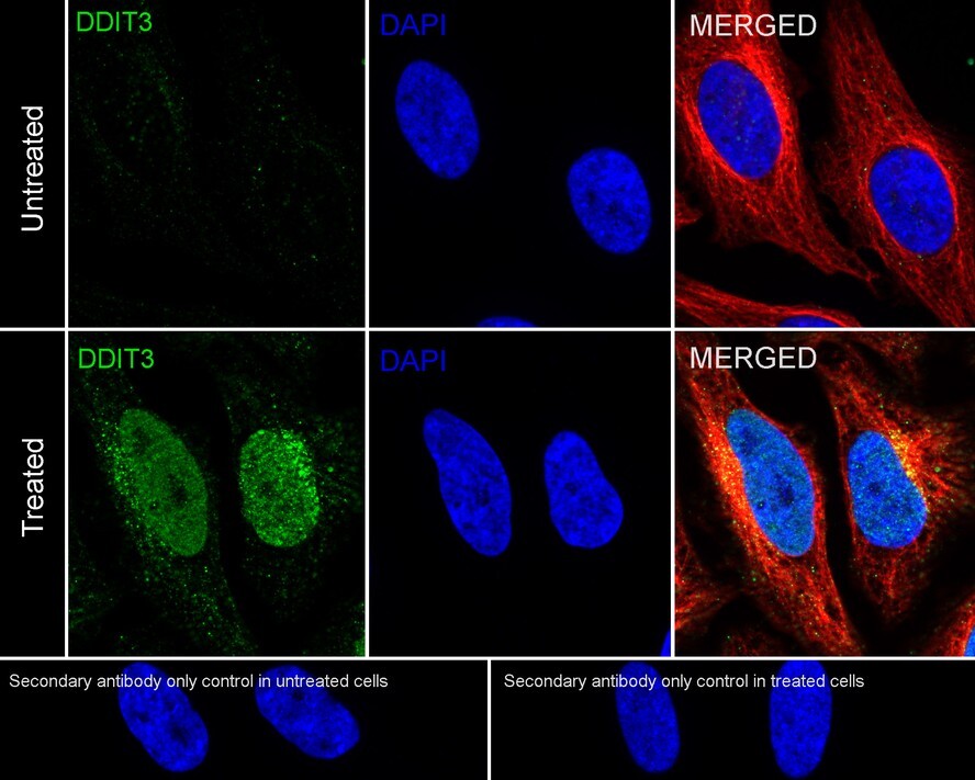 HuabioResearch's tweet image. Our DDIT3 recombinant mAb is BSA- and azide-free, giving you cleaner signal and full flexibility for conjugation. Validated in WB, IF, and FC. hubs.li/Q048drYt0

Use code HuabioPBS25 for 25% off carrier-free antibodies.

#antibodies #lifescience #research #ERstress