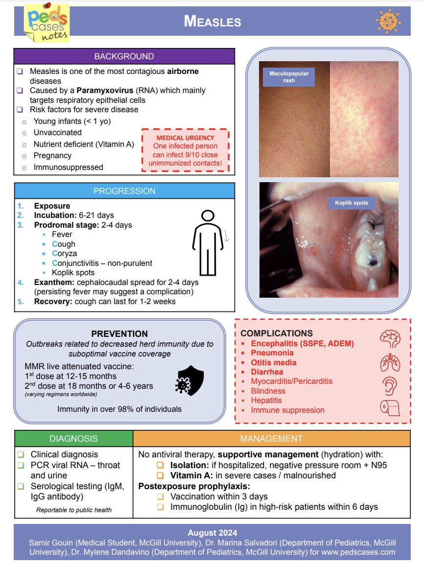 OnSquares's tweet image. Summary of Measles Infection 

📖 By: @PedsCases 
#Pediatric #InfectiousDiseases