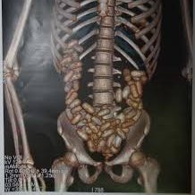 The News tweet media