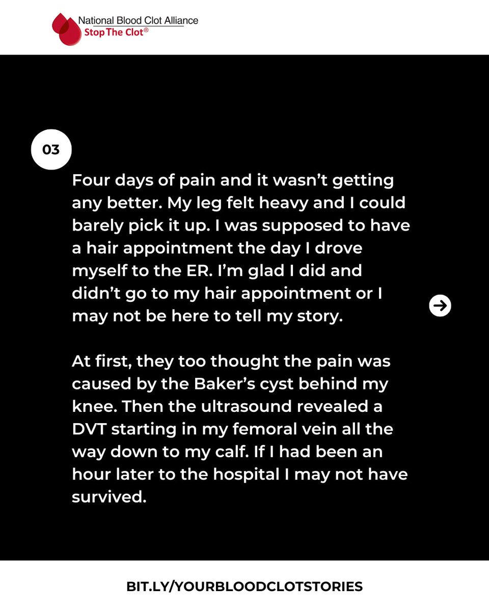 StopTheClot's tweet image. She nearly skipped the ER for a hair appointment.

Thankfully, she didn’t.

What seemed like a pulled muscle was actually a life-threatening DVT.

Know the symptoms. Listen to your body.

Thank you for sharing your story, Miranda.

#StopTheClot #DVT #BloodClots