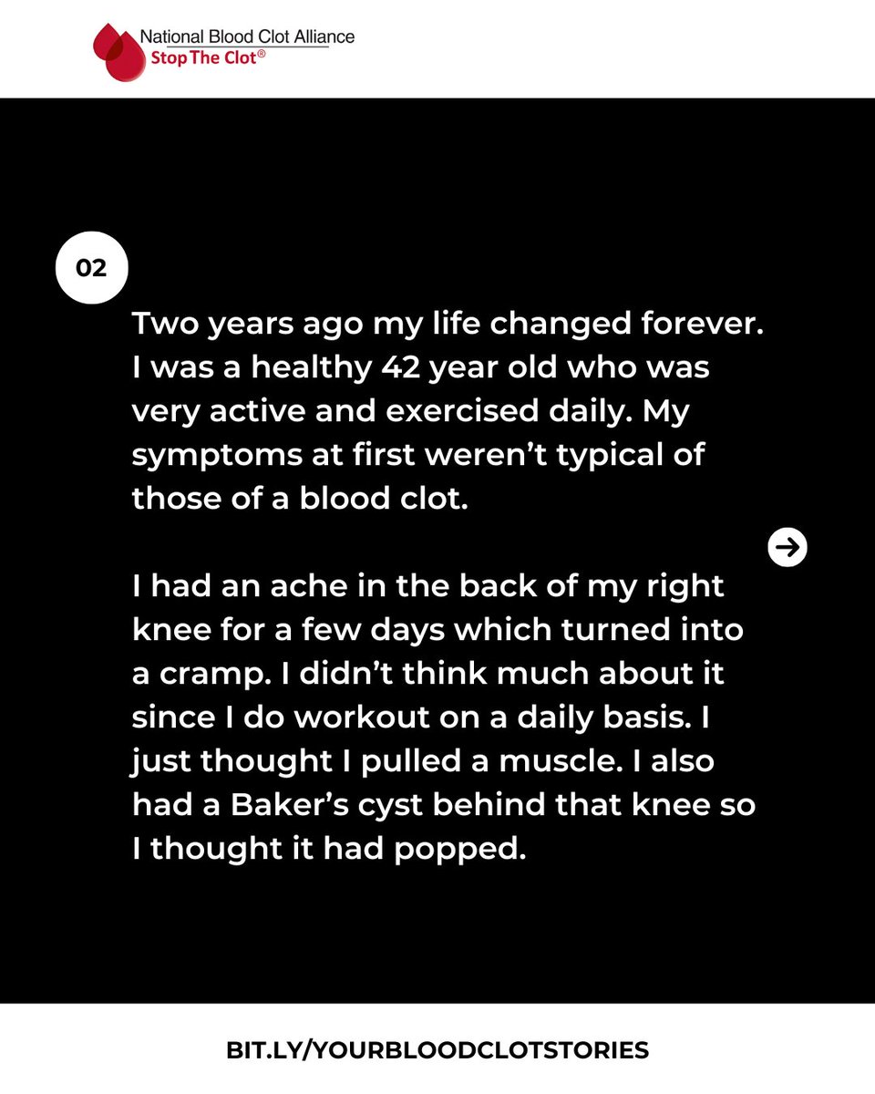 StopTheClot's tweet image. She nearly skipped the ER for a hair appointment.

Thankfully, she didn’t.

What seemed like a pulled muscle was actually a life-threatening DVT.

Know the symptoms. Listen to your body.

Thank you for sharing your story, Miranda.

#StopTheClot #DVT #BloodClots