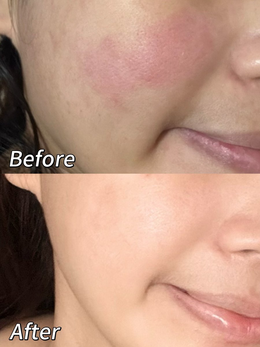 brink🧚‍♀️ tweet media