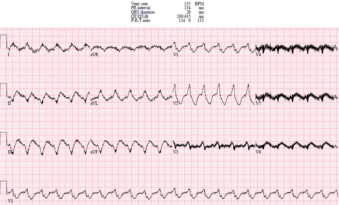 ECGWeekly tweet media
