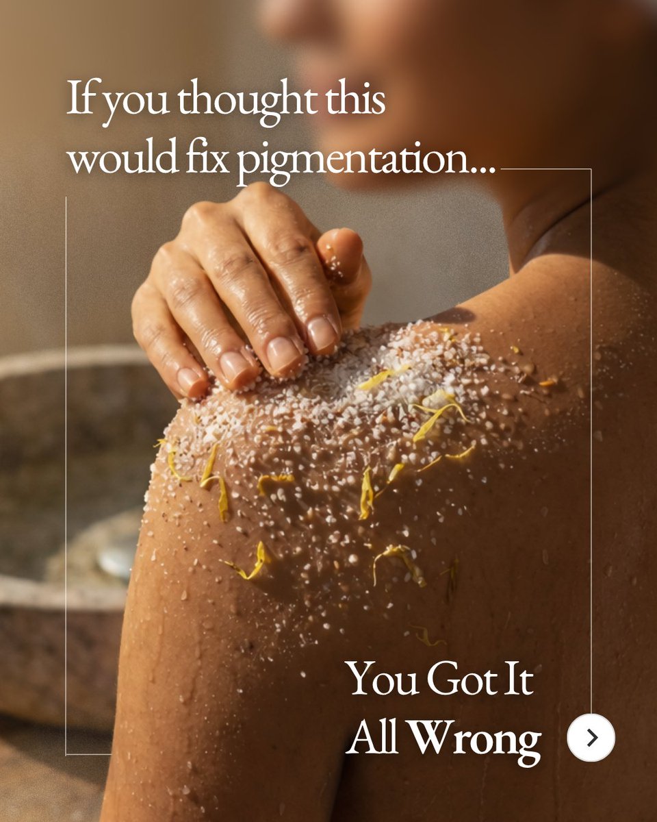 Zennara_clinic's tweet image. 🚨 PSA: That #DIY scrub you're using on your dark #underarms/ #knees ? 

You're making it WORSE

Thread on what actually works for #pigmentation 🧵

🌐 zennara.in

#SkinCare #Dermatology #Hyderabad #SkinMyths #LaserTreatments