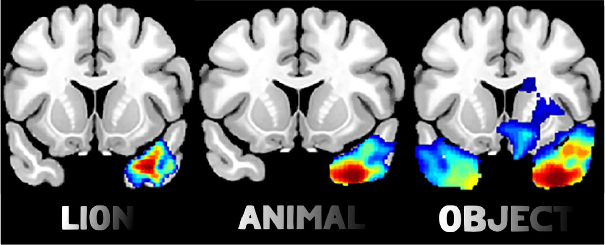 Brain tweet media
