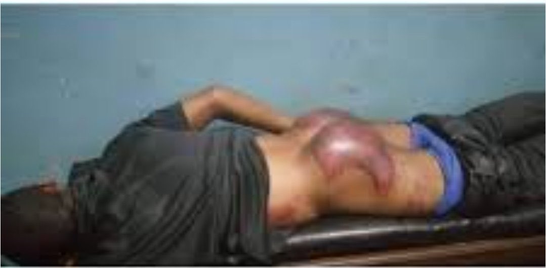 état actuel du compatriote que les Militaires de l’artiste avaient fouetté.