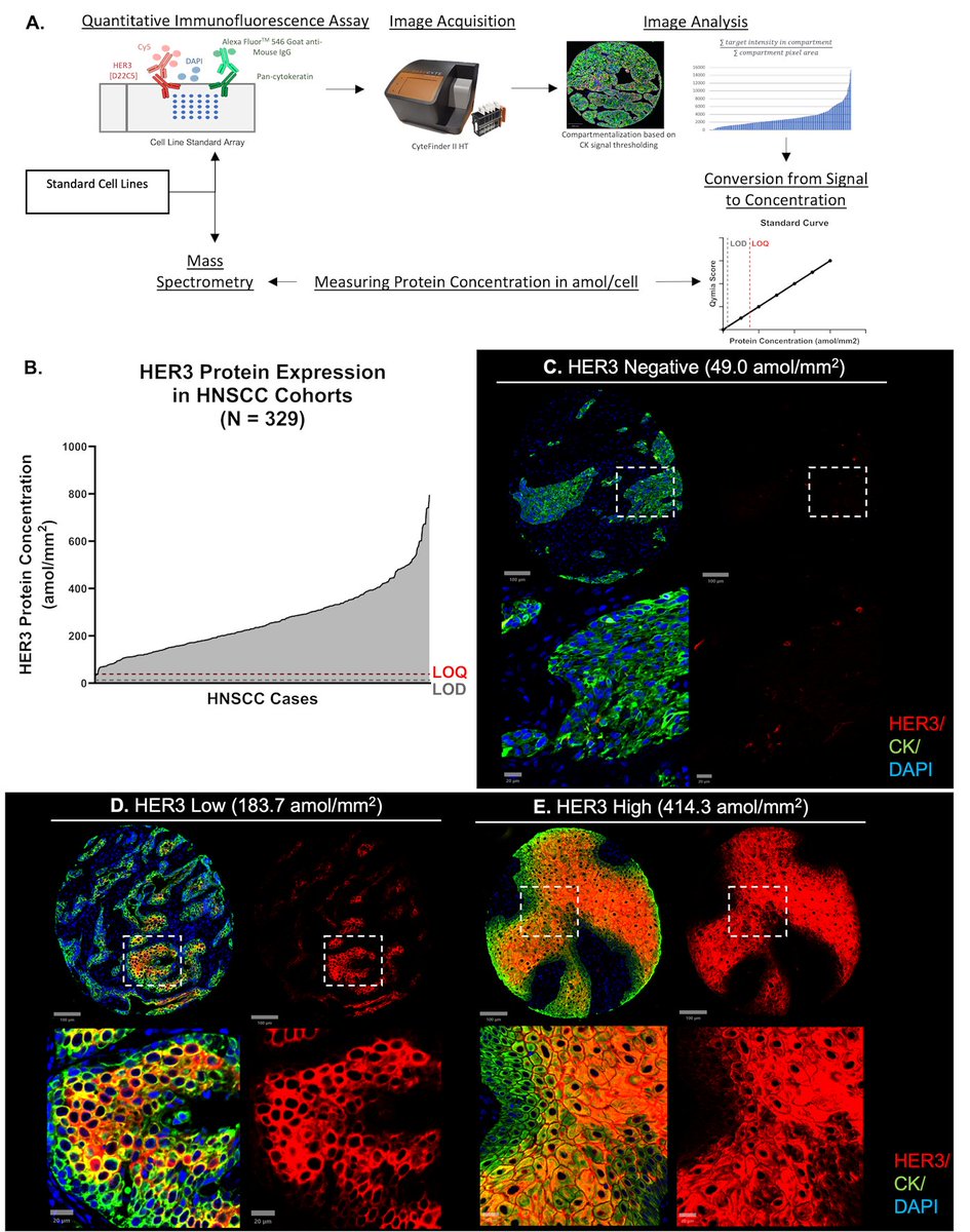 MCT_AACR's tweet photo. Online now! Simultaneous publication with an @AACR Annual Meeting 2026 Advances in Technologies Session: Quantification of Antibody-Drug Conjugate Targets in Head and Neck Squamous Cell Carcinoma https://t.co/RtN2cILnpE #AACR26 https://t.co/lA6EcnYdDr
