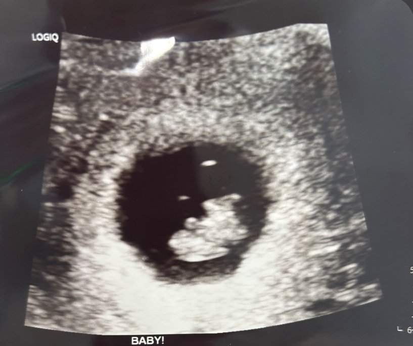 RAISED BY WOLVES 🇺🇲🩺🐕❤✝️ tweet media