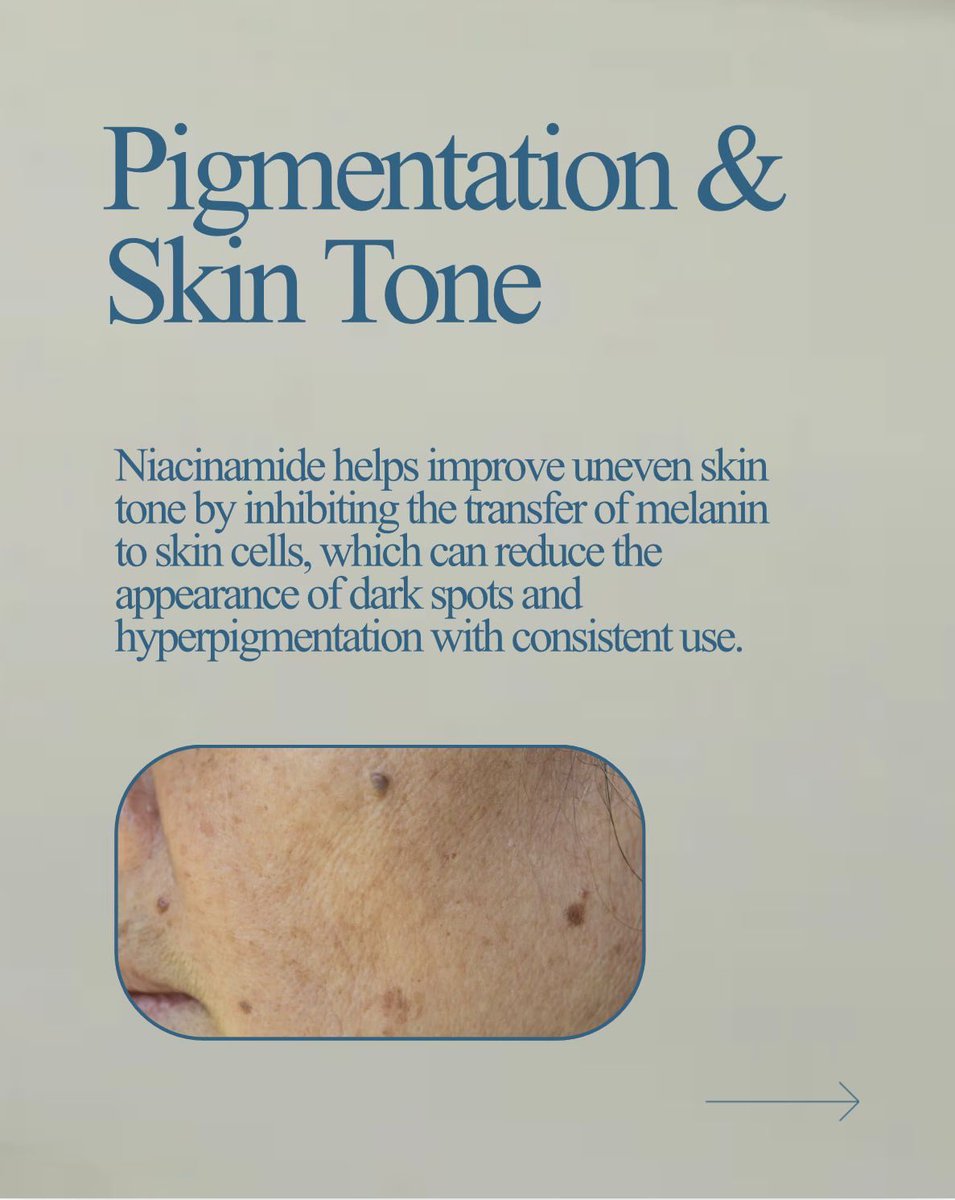 DermMedGroup's tweet image. Niacinamide is everywhere—but find out what it’s really doing for your skin.

It’s one of the few ingredients that works for almost everyone—acne-prone, sensitive, or barrier-damaged skin.

#niacinamide #skincare #dmgnc #skincareingredients