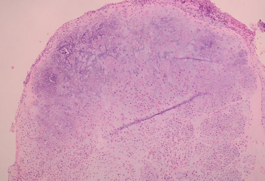 UAB Pathology tweet media