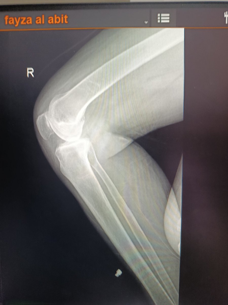 S 🍓Areej tweet media