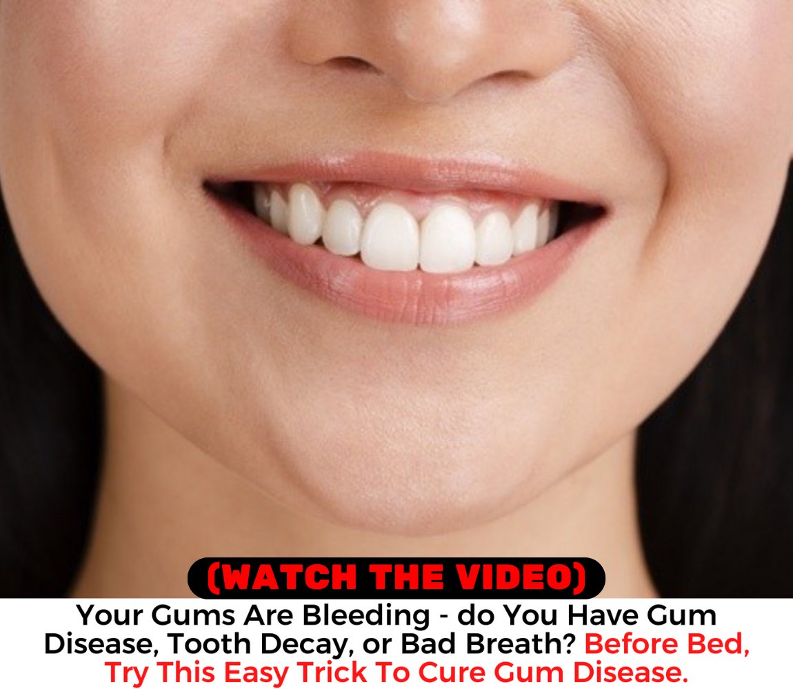 WinJose8's tweet image. #dental #dentalcare #teethgoals #prodentimprobiotic
#teeth #smiles #prodentim #whiteteeth #healthcare  
#OralCare #tooth #decay #viral #DentalHealth
Improve your oral hygiene routine 
with our innovative dental product.
👇Click to learn more👇
👉 f.mtr.cool/anpnxwzmdw 👈