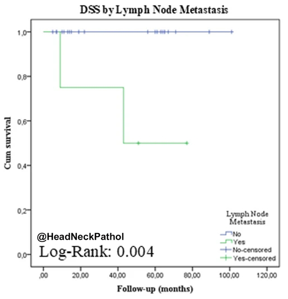 HeadandNeckPath's tweet photo. Characterization of CD8 + &amp; CD68 + Microenvironment &amp; PDL1 Expression in HPV-related Multiphenotypic Sinonasal Carcinoma
Silva de Araújo, Gonçalves de Paiva, Lima Fernandes, et al.
https://t.co/mukMe221k7
#HeadNeckPathol #HNPJ #HeadandNeckPath #Pathology #ENTPath #PathologyTweet https://t.co/SGDCAC3CtQ